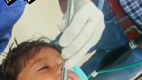 Coin remove from child mouth Proud of doctor and nurse