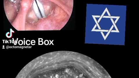THROAT CHAKRA