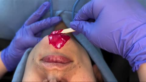 Chin Waxing Tutorial Using Sexy Smooth Cherry Desire Hard Wax | @lils._esthetics