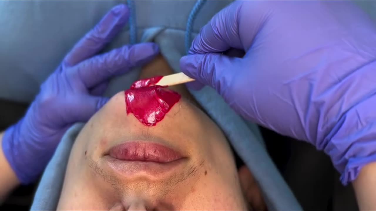 Chin Waxing Tutorial Using Sexy Smooth Cherry Desire Hard Wax | @lils._esthetics