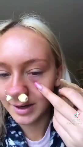 Garlic Treatment for 15 minutes...