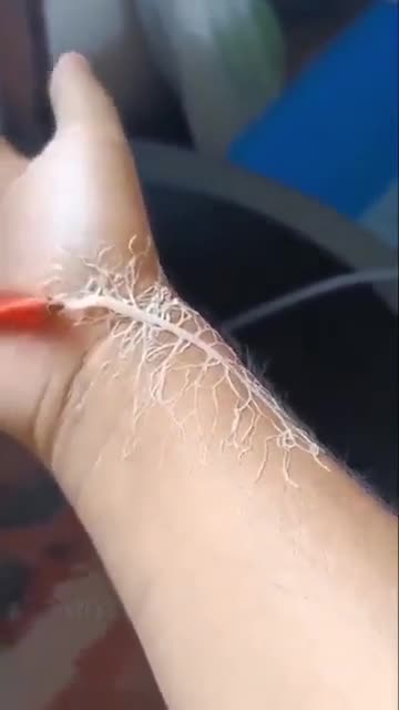 RIBBON WORM DEMONSTRATES HOW PARASITE WORK, WHY IVERMECTIN BANNED