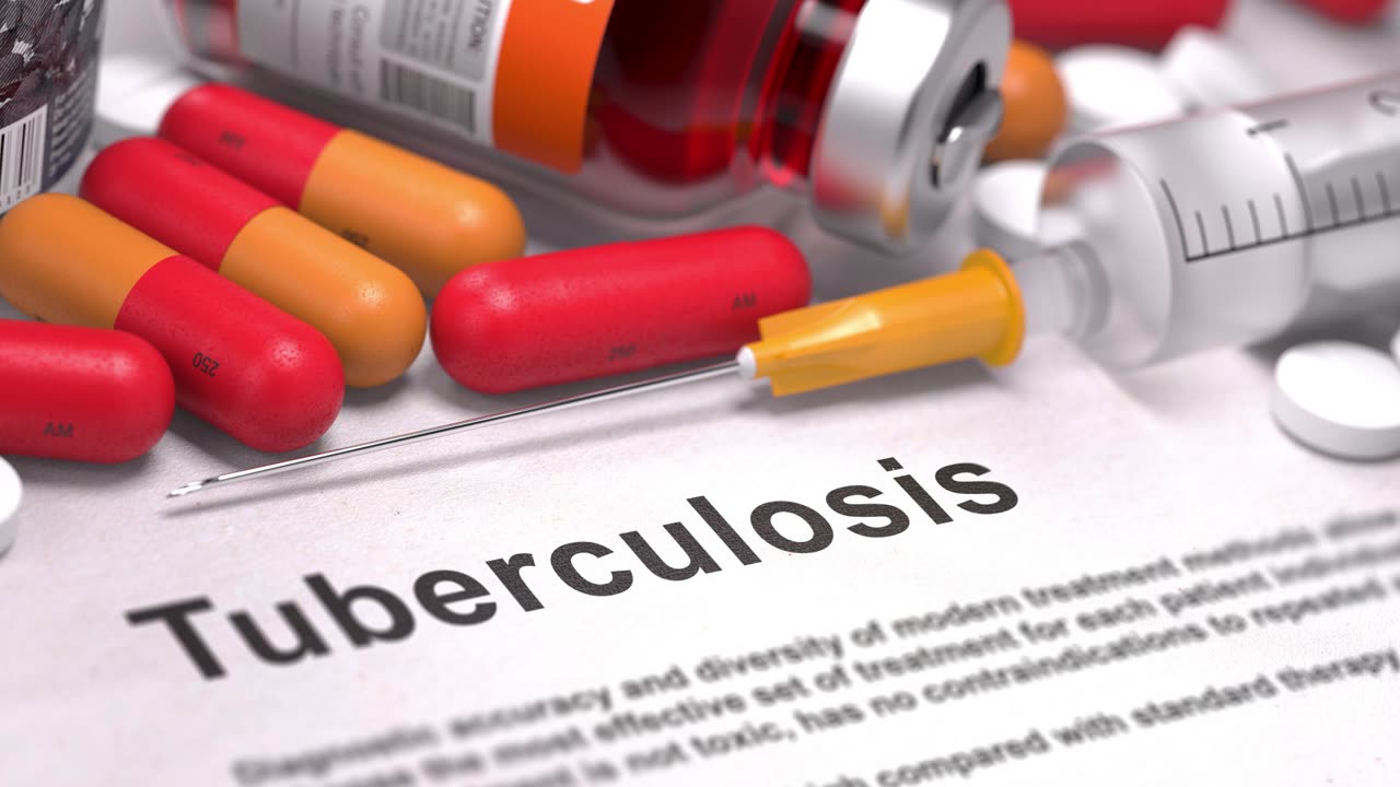 US Tuberculosis Cases Rise, Highest Numbers In A Decade, Non-Citizens