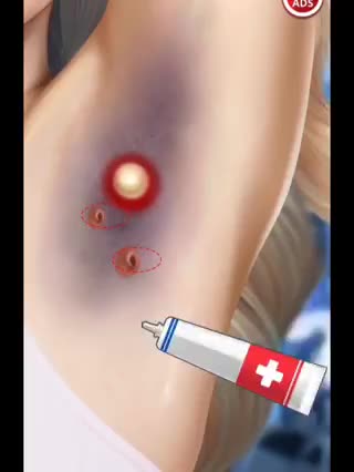 Arms Treatment for side infection