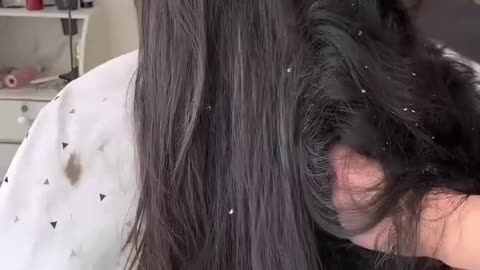 lady headshave because of dandruff