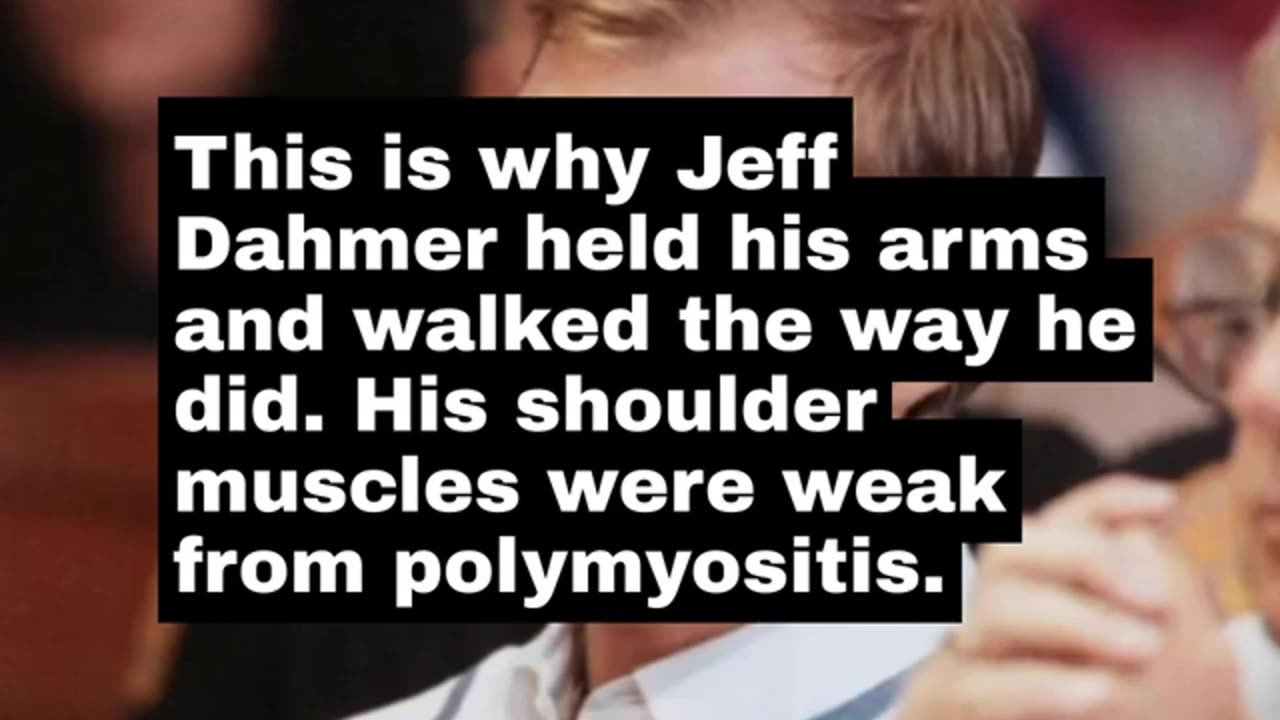 Jeff Dahmer Had Polymyositis. The Story Collapses As He Was Incapable Of Doing What the MSM said