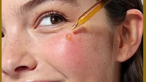 Cliganic Organic Rosehip Seed Oil for Face, 100% Pure