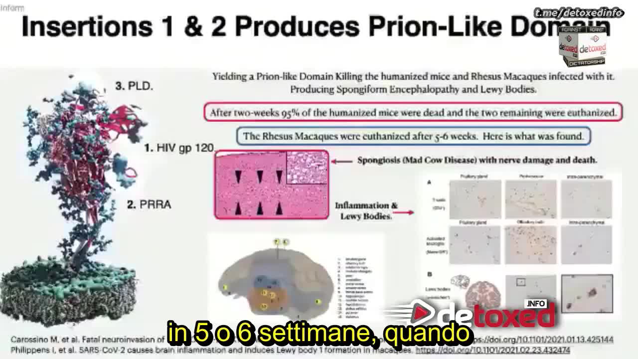 LA PROTEINA SPIKE CONTENUTA NEI SIERI SPERIMENTALI TRASFORMA IL CERVELLO DEI VACCINATI.