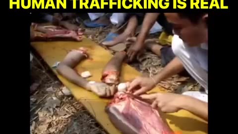 HUMAN ORGAN HARVESTING - THIS IS SICK