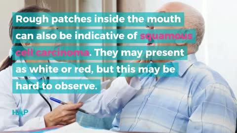 Symptoms Of Squamous Cell Carcinoma