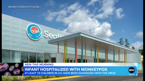 Infant hospitalized with monkeypox in Washington state GMA