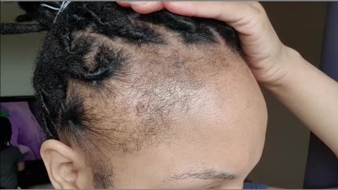 Care for hair growth