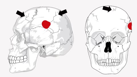 Anatomy of a Headshot