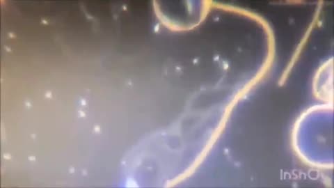 BLOCKBUSTER_ Blood Sample of vaxxed person shows LIVING HYDRA VULGARIS SWIMMING AROUND!