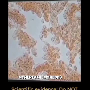 DO NOT HAVE SEX WITH VACCINATED PEOPLE 💉💉💉💉s🐍🐍🐍