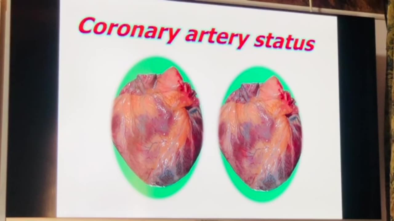 Basic ECG