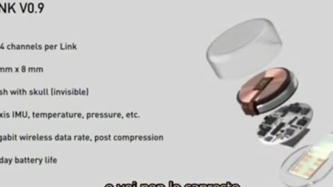 ELON MUSK, NEURALINK - ENTRO 6 MESI NEL CERVELLO UMANO