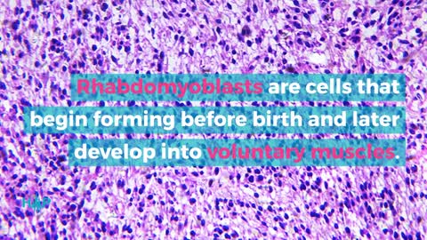 Options For Treating Rhabdomyosarcoma