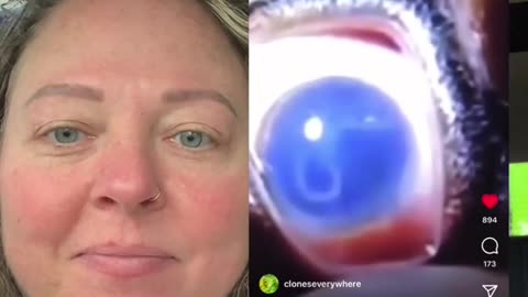 Parasites In The Jabbed