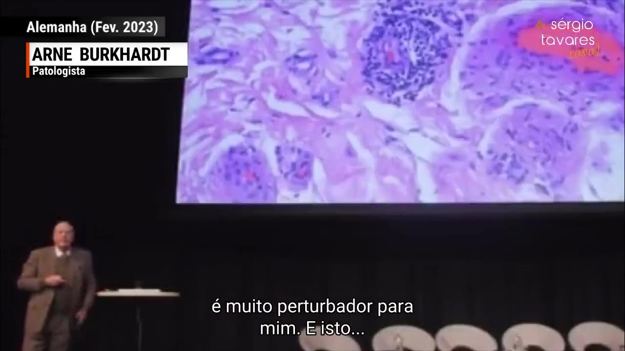 Proteína Spaik está matando os seres humanos.