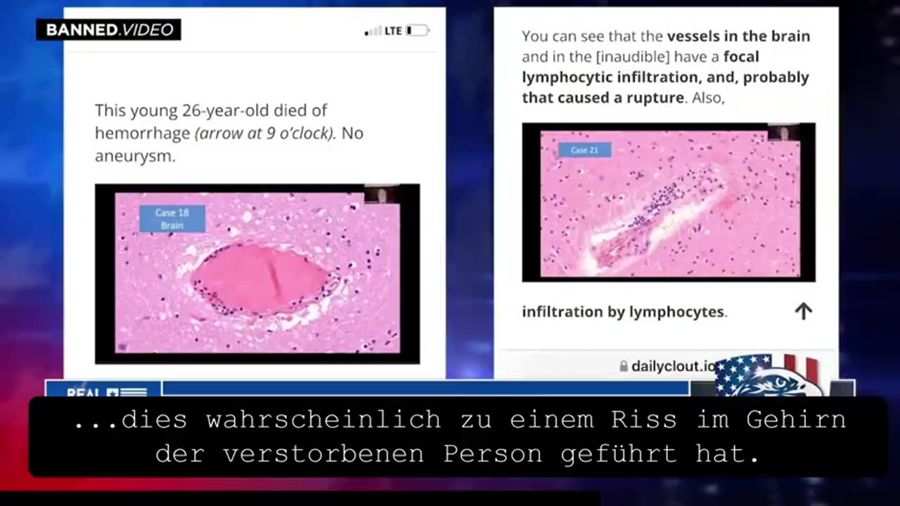 DR.NAOMI WOLF: DIE COVID-IMPFUNG IST EINE BIOWAFFE / THE COVID VACCINE IS A BIOWEAPON