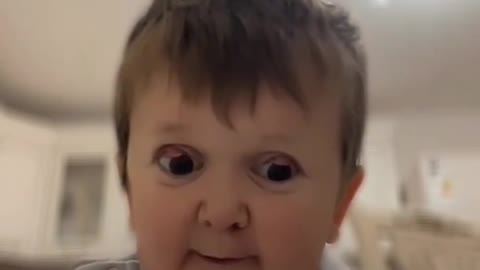 Hasbulla cobra funny video