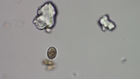 A Euglypha Amoeba