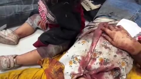 Video dai bombardamenti di Gaza