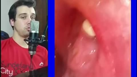 Липомы во рту у девушки очень штука такая