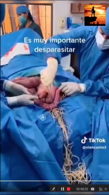 Parasito, desparasitacion,