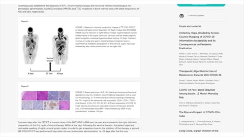 case report of extrardinary linfoma progression after biontech vaccine