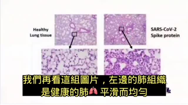 美國醫生講解疫苗進入人體的影響