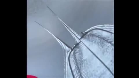 Tubular micro-structures appear under the microscope