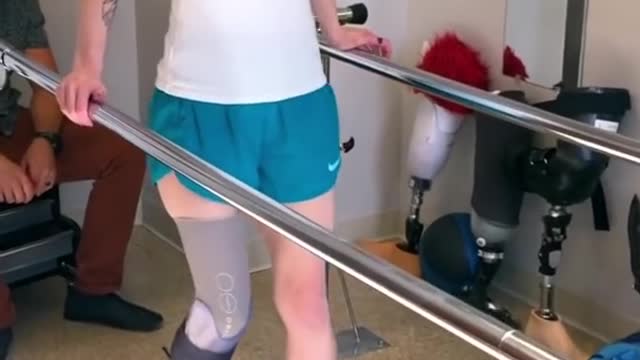 How long does it take to learn to walk on a prosthetic leg?