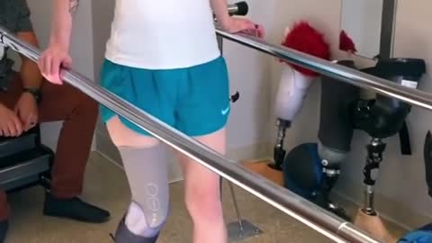 How long does it take to learn to walk on a prosthetic leg?