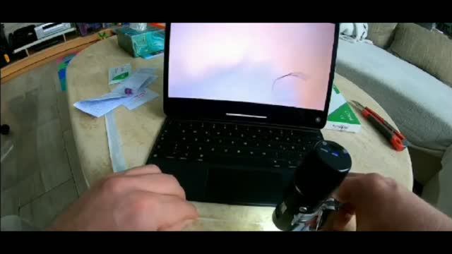 CHOROBA MORGELLONÓW - Morgellons inside Covid19 nose tests