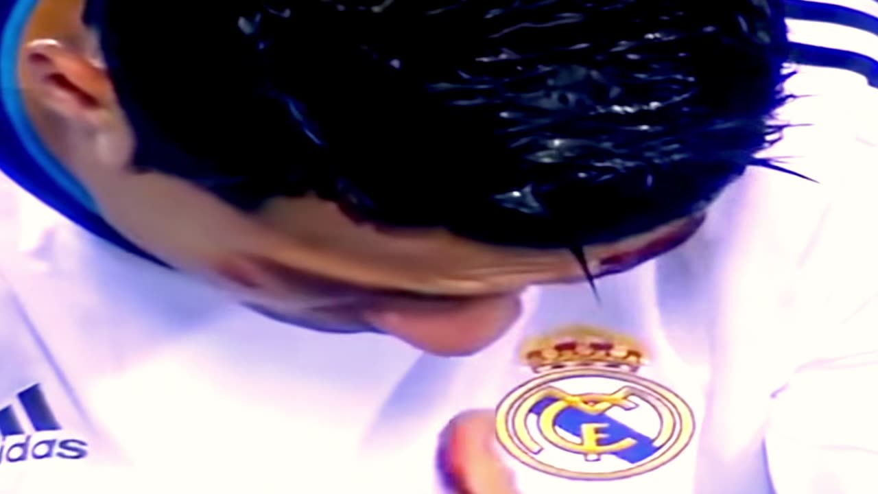 Cristiano Rubaldo Injured 😲😱😱 | Eye Bleeding 🩸🩸 #shorts