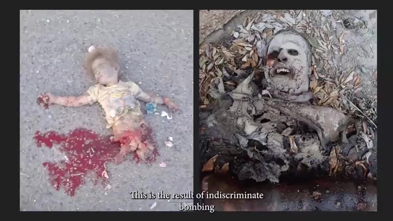 Health Care in War Zones_ What a Doctor Witnessed in Gaza __ Warning__ GRAPHIC