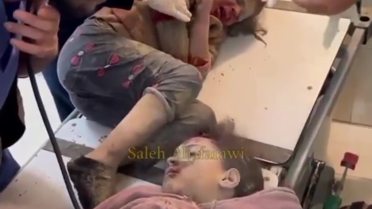 Children injured in Gaza during Israeli Sword of Iron Operation