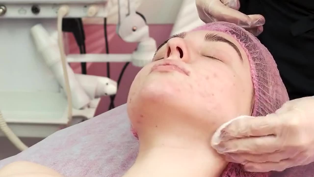 Best facewash for your skin