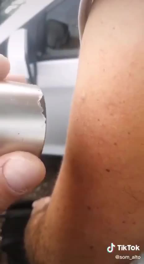 يجذب المغناطيس مكان اللقاح 2