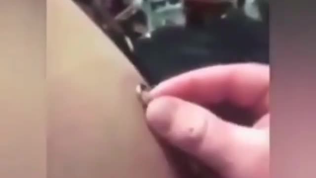 I vaccinati vengono microchippati?