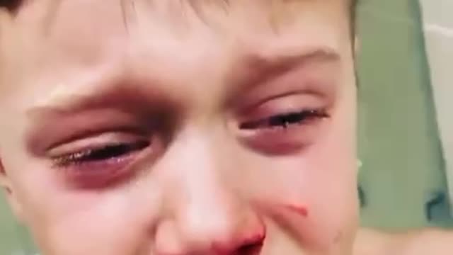 Kid suffering from a corona nasal swab, this is torture