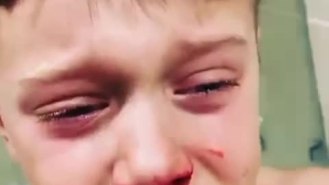 Kid suffering from a corona nasal swab, this is torture
