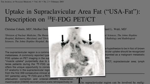 Brown Fat: Losing Weight Through Thermogenesis