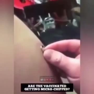 Calamita dopo il vaccino