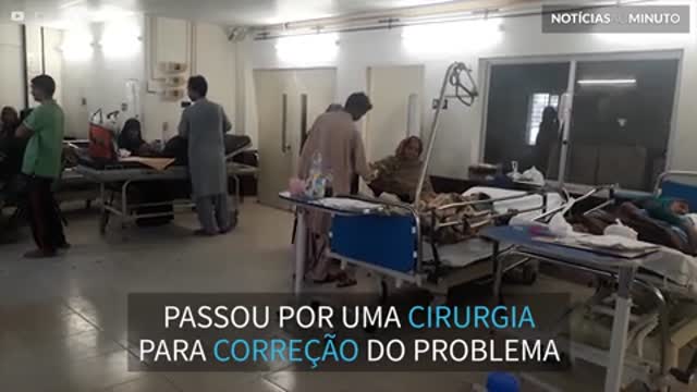 Criança com rara deformidade no nariz passa por cirurgia