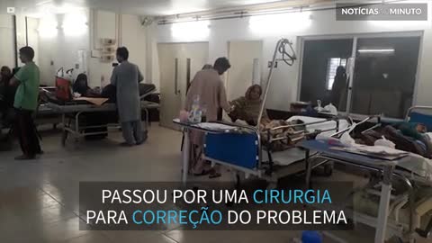 Criança com rara deformidade no nariz passa por cirurgia