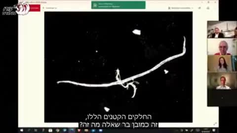 בדיקת תוכלת החיסונים - חלקיקים חשודים בגודל עד לחציא מ"מ