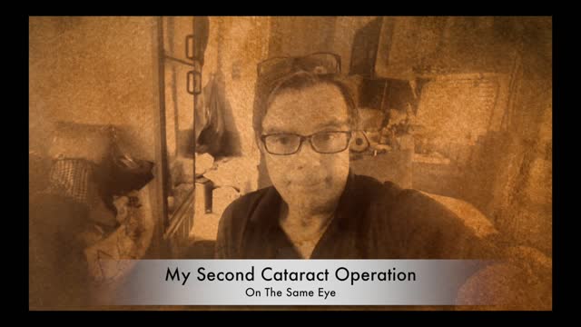 Cataract Surgery: The Operation Damaged My Vision For Life